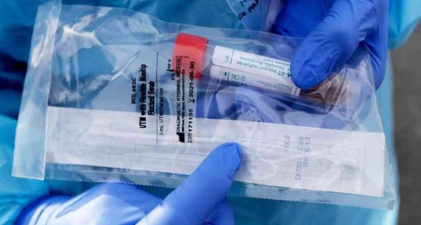 El Gobierno compra medio millón de reactivos para detectar coronavirus