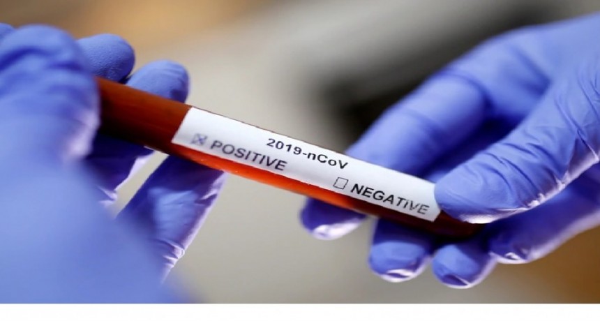 Argentina: presentan un ensayo clínico local de tratamiento antiviral contra COVID-19