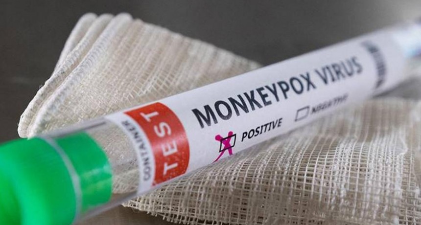  Argentina confirman el segundo caso de viruela del mono 