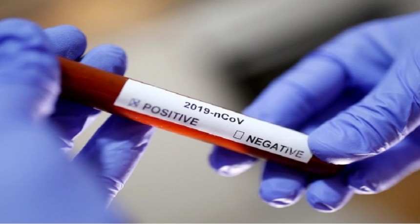 Aprueban versión del test rápido argentino para detección de coronavirus